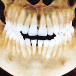 3D Dental Scan CBCT Raipur
