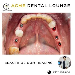 Acme Dental Lounge® | Best Dentist in Aundh Pune