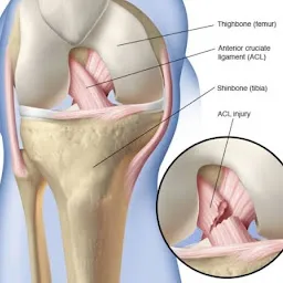 Advanced Knee & Shoulder Surgery