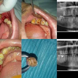 Anu's Dental-అనూస్ డెంటల్ & Implant Centre - RTC X Roads