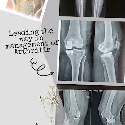 Dr. Anuj Singh - Best Orthopaedic Surgeon in Kandivali, Mumbai | Hip & Knee Replacement | Arthroscopy | Fracture Treatment