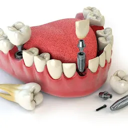 Asraf's Oral Maxillofacial & Dental Implant Centre