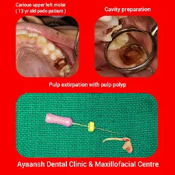 Ayaansh Dental and Implant Clinic and Maxillofacial Centre