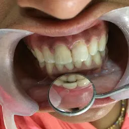 Bhargav Dental and Implant Centre