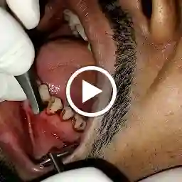 Bhatt Dental