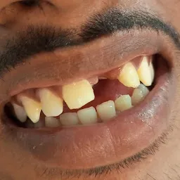 Bhowmik Dental Clinic Vapi