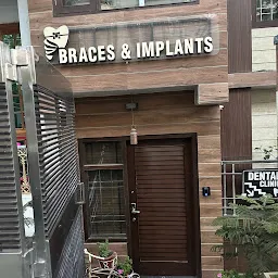 Braces & Implants Dental Clinic in Shimla