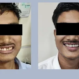 Chandeshwar Dental Clinic Implant and Orthodontic Centre