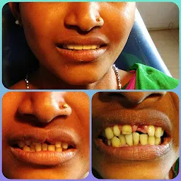 clean(क्लीन) n healthy(हेल्दी) dental clinic jagdalpur