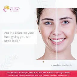Cleo Skin Clinic - Kukatpally
