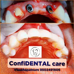 ConfiDENTAL care dental clinic & IMPLANT CENTER