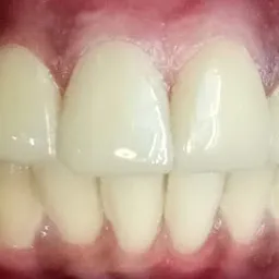 Dazzle Dental care