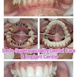 Dede Multispeciality Dental Care And Implant Centre
