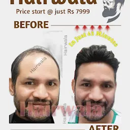 Delight Hair Replacement-Best Hair Wig/Hair Patch/Hair Weaving Service