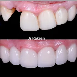 DENTA SMILE DENTAL CLINIC AND IMPLANT CENTRE