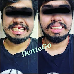 DenteGo- Endo Speciality Dental Clinic
