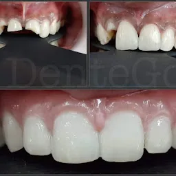 DenteGo- Endo Speciality Dental Clinic