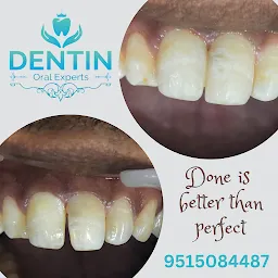 DENTIN Oral Experts