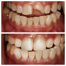 Dento-32 Multi Speciality Dental Clinic