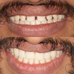 Dento-32 Multi Speciality Dental Clinic