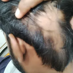 Dr. Shri Nivash (DERMA HEALTH) Laser Skin & Hair Clinic