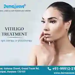 Dermawave skin laser Hair Transplant | Sumit skin care Clinic