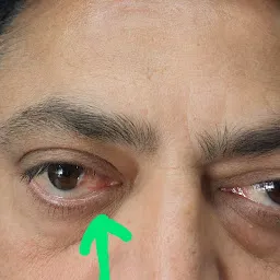 Divyadrashti Eye Clinic
