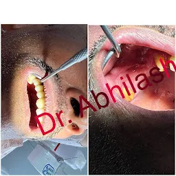 Dr. Abhilash’s Elite Dental Clinic, Branch-1 Nazira