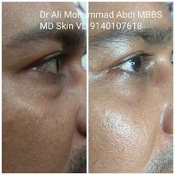 Dr Ali Mohammad Abdi MBBS, MD(SKIN &V.D) SHAFIA'S SKIN AND HAIR CLINIC