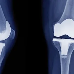 Dr. Amit Sharma / Best Orthopedic,knee, hip and shoulder Joint replacement Doctor in Jodhpur