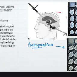 Dr. Anand Sharma -Best Spine & Neurosurgeon In Gwalior -Neurologist/Neurology Doctor -Stroke/Back/Neck Pain/Brain Specialist