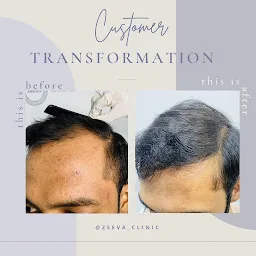 Dr Anchal Shah: Zeeva Skin & Hair Transplant Clinic