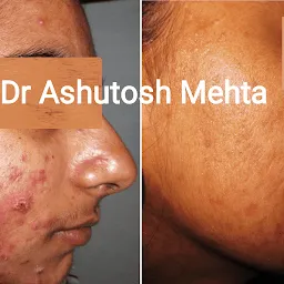 Dr Ashutosh Mehta