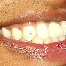 Dr Atul Shringarpure's Bright Smile Dental Clinic