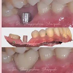 Dr. Bhagyashree’s Dental Clinic and Implant Centre