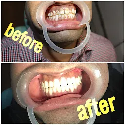 Dr.Gaurav Dental Care