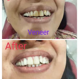 Dr Itika singla( Teeth and face clinic)