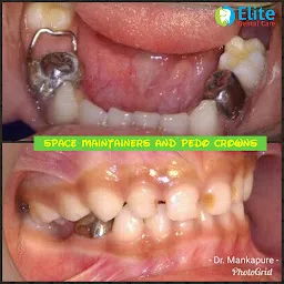 Dr. Mankapure's Elite Dental Care