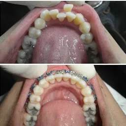 Dr. Mohneesh Gehlot Dental Care