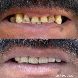 Dr Pranjal Bora Dentist