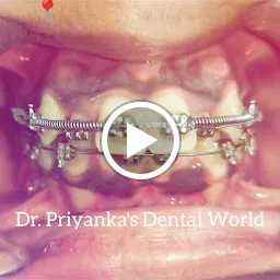 DR. PRIYANKA'S DENTAL WORLD - Best Dental Clinic | RCT Treatment | Top Dental Implant Centre in Haridwar