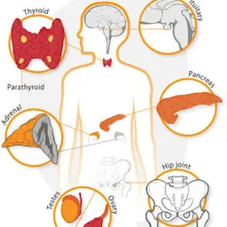 Dr Purvi Chauhan Diabetologist & Endocrinologist