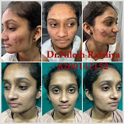 Dr.Rafaliya's Clinic - Best Hair Transplant | Skin Care Clinic Ahmedabad