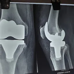 Dr. Raj Kumar Garg - Best Orthopedic Surgeon In Gwalior | Trauma & Fracture Surgery - Hip & Knee Joint Replacement