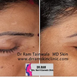Dr Ram Skin Hair & Cosmetic Clinic - Dr Ram Tainwala (Sunder Nagar)