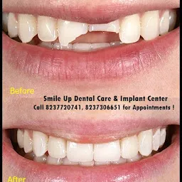 Dr Ratnika's - Smile Up Dental Clinic & Implant Center