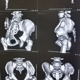 Dr. Ravi Teja Boddapalli Orthopaedic Surgeon | Apollo Hospitals | Orthopaedic Doctor, Visakhapatnam(Vizag)