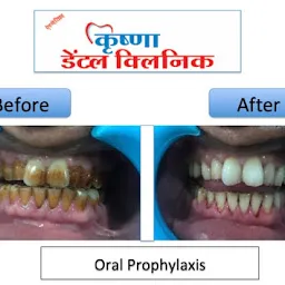 Dr Rohit Raghuvanshi (MDS), Krishna Dental Clinic