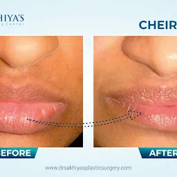 Dr. Sakhiya's Plastic Surgery Center