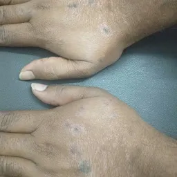 Dr. Sanghmitra Gudge's Skin Clinic